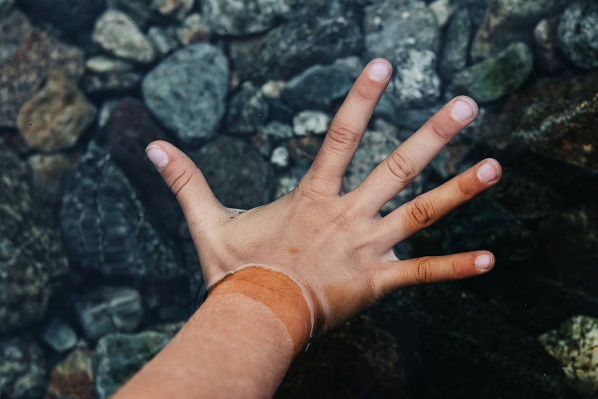 How to Handle Eczema Nails Without Losing Your Sanity (Seriously)